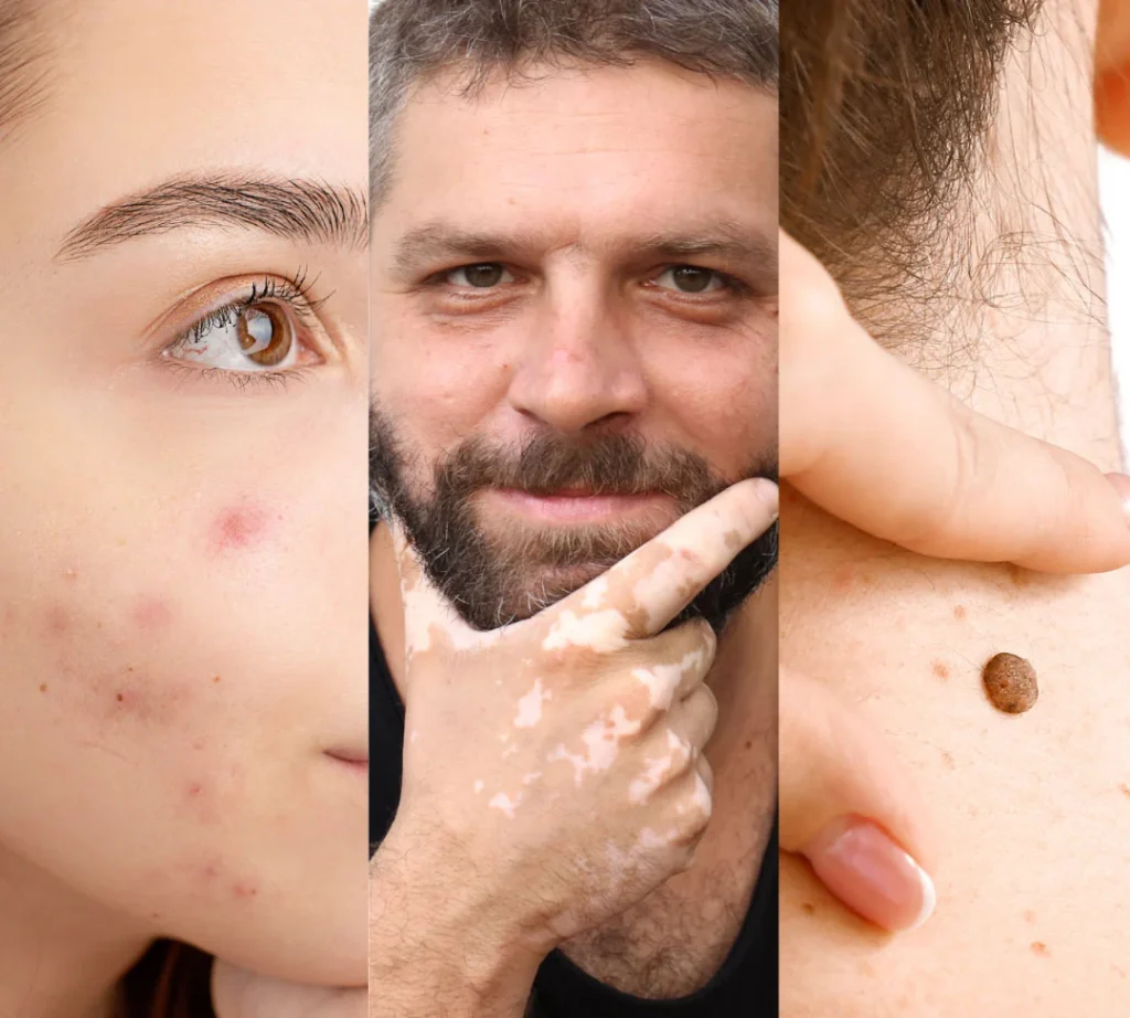 clinica-dermatologie-bucuresti-mobil