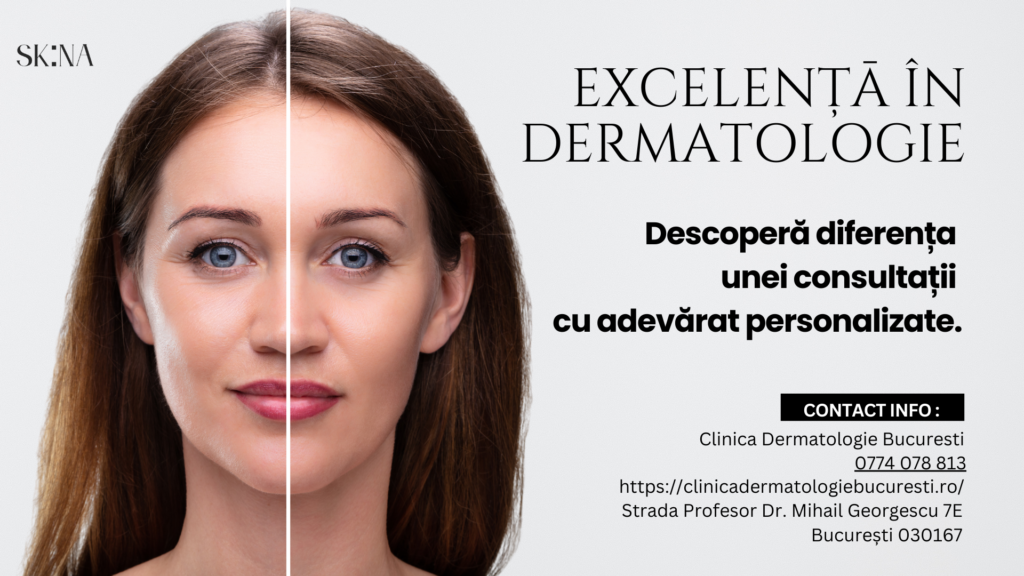 consult dermatologic bucuresti 280 lei